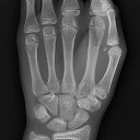 Hand X-Ray by Nevit Dilmen